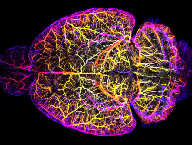 Brain vasculature