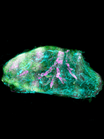 Cleared human kidney