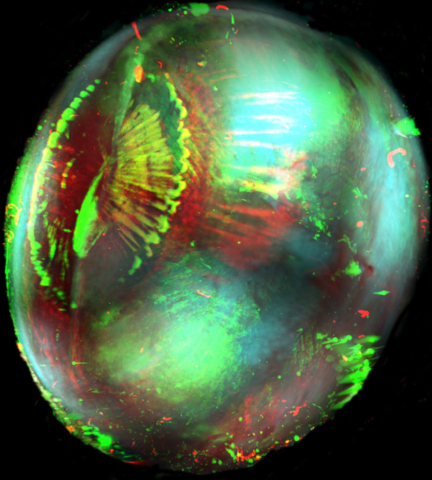 Human eye · cleared
